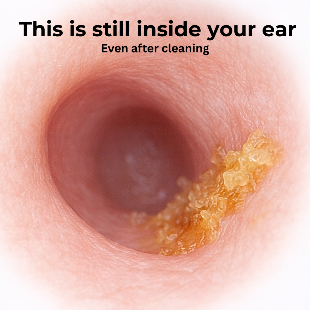 Waxby™ Visual HD Ear Cleaning System